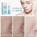 LANTHOME DARK SPOT CORRECTOR REMOVER