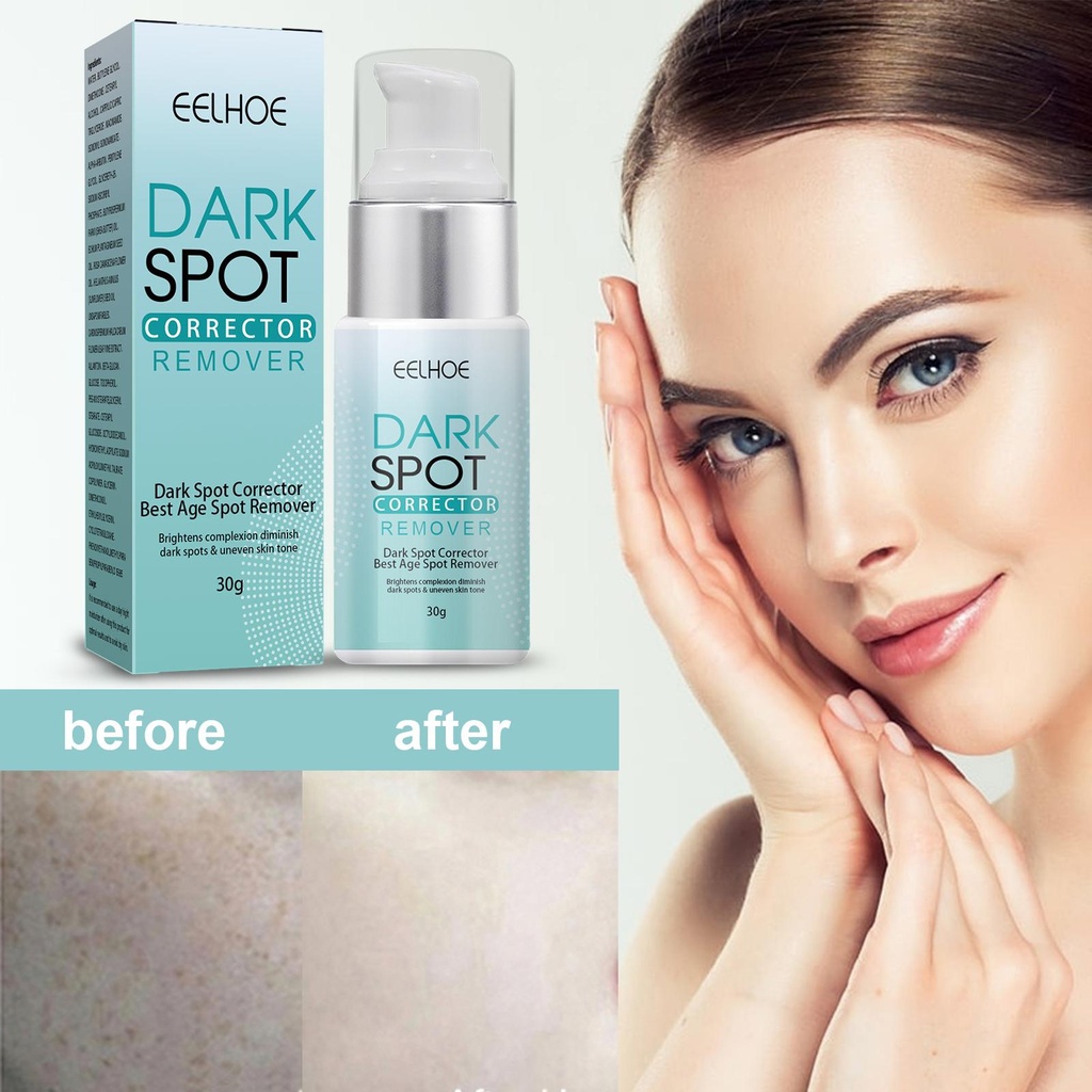LANTHOME DARK SPOT CORRECTOR REMOVER