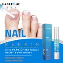 LANTHOME NAIL REPAIR