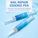 LANTHOME NAIL REPAIR