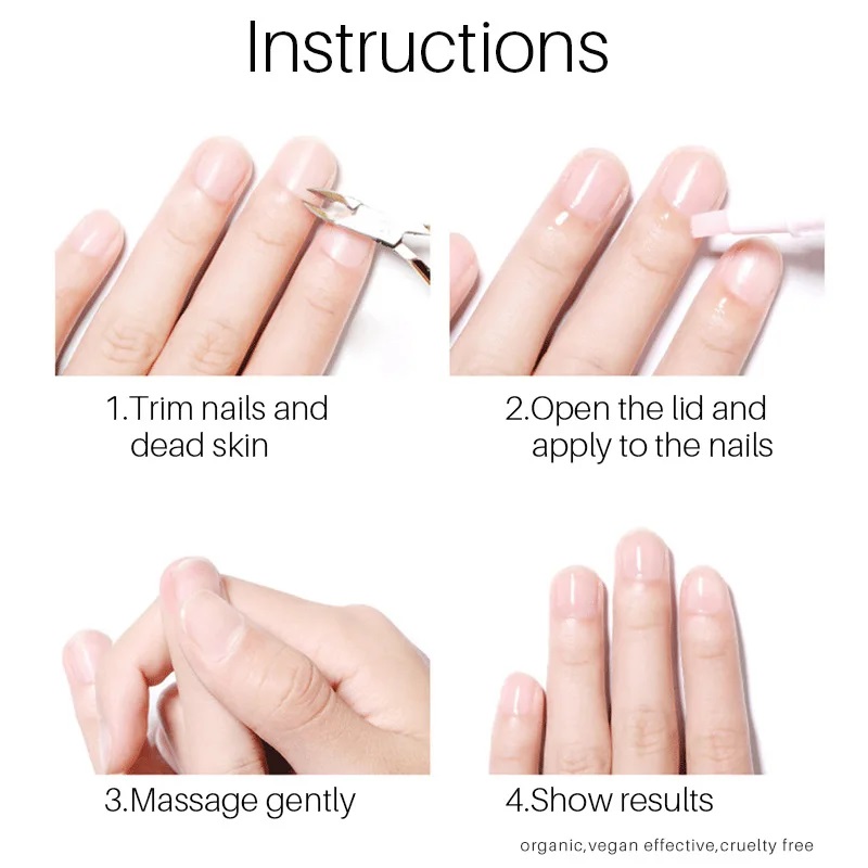 LANTHOME NAIL REPAIR