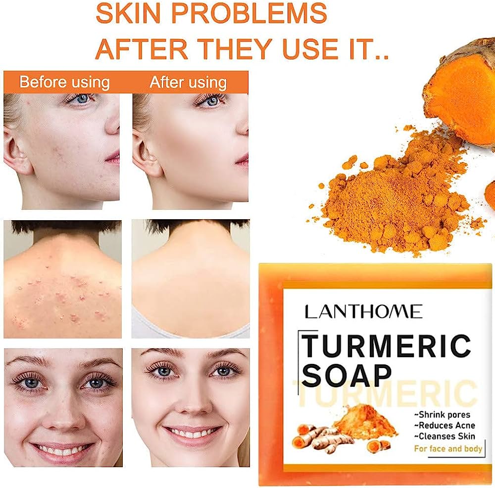 LANTHOME TURMERIC SOAP