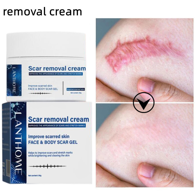 Lanthome scar removal cream