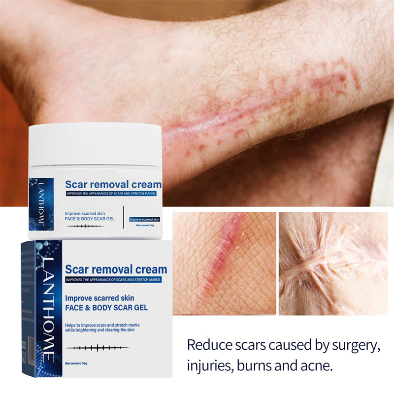 Lanthome scar removal cream