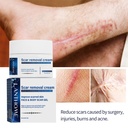 Lanthome scar removal cream