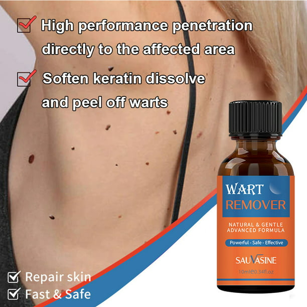 SAUVASINE WART REMOVER