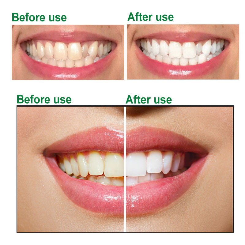 DR.RASHEL ALOE VERA TOOTH PASTE _ RESTORES WHITENESS