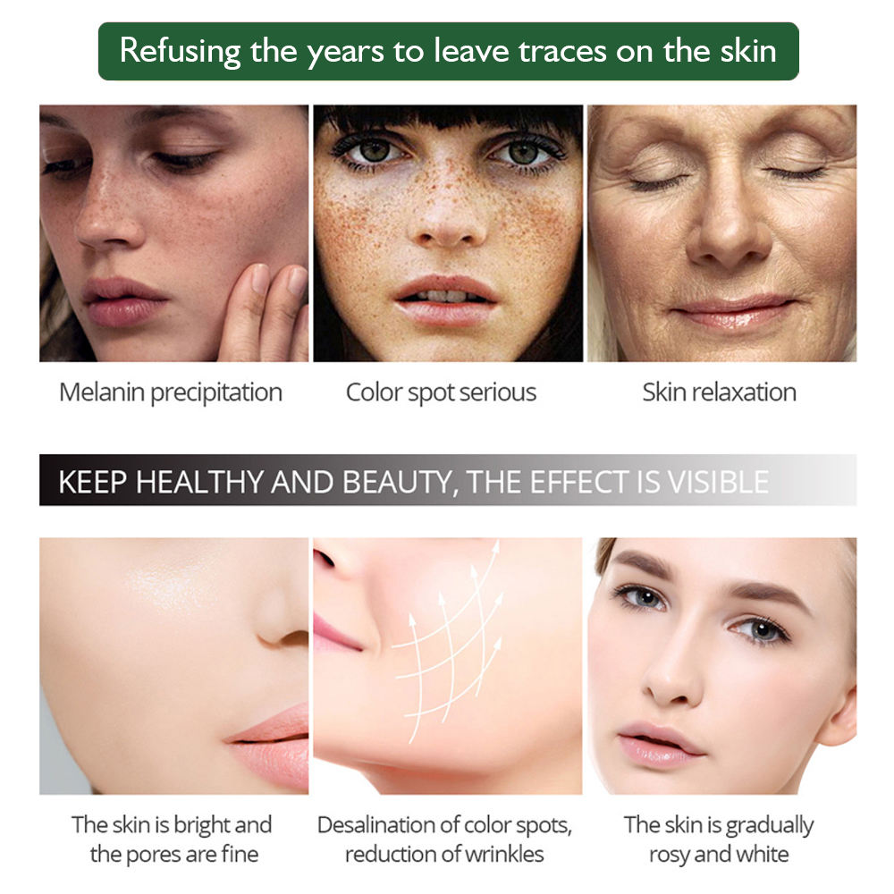 AICHUN BEAUTY ANTI-FRECKLE WHITENING FACIAL SERUM