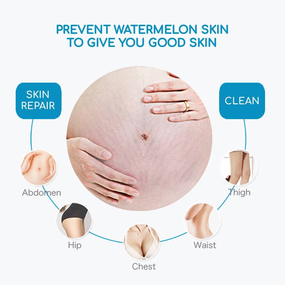AICHUN BEAUTY ANTI-STRETCH MARK CREAM