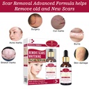 AICHUN BEAUTY REMOVE SCARS WHITENING FACIAL SERUM KOJIC ACID & VITAMIN E