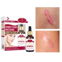 AICHUN BEAUTY REMOVE SCARS WHITENING FACIAL SERUM KOJIC ACID & VITAMIN E