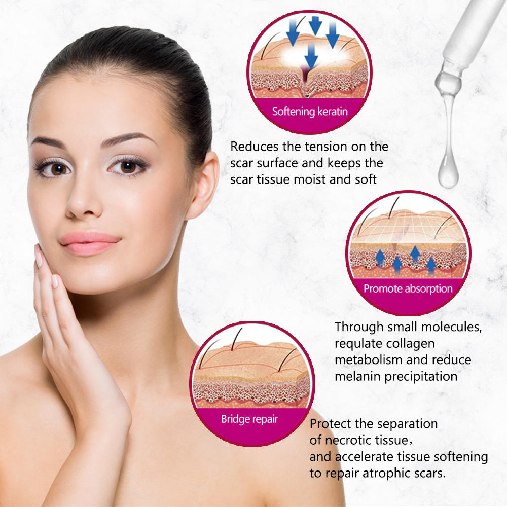 AICHUN BEAUTY REMOVE SCARS WHITENING FACIAL SERUM KOJIC ACID & VITAMIN E