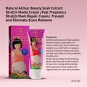 AICHUN BEAUTY STRETCH MARKS CREAM SNAIL EXTRACT