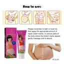 AICHUN BEAUTY STRETCH MARKS CREAM SNAIL EXTRACT