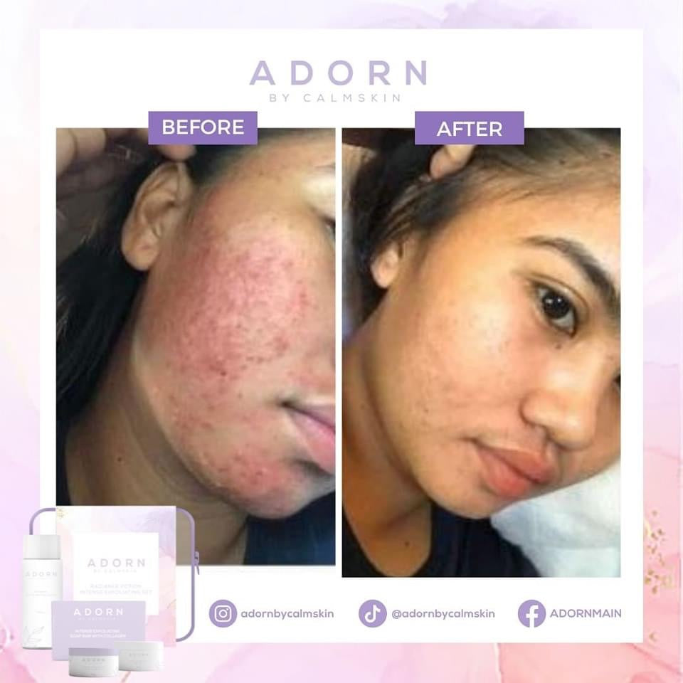 ADORN RADIANCE POTION INTENSE EXFOLIATING SET