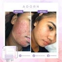 ADORN RADIANCE POTION INTENSE EXFOLIATING SET