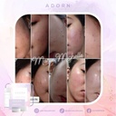 ADORN RADIANCE POTION INTENSE EXFOLIATING SET