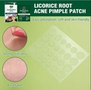 Aichun Beauty LicoriceRoot Acne Pimple Patch